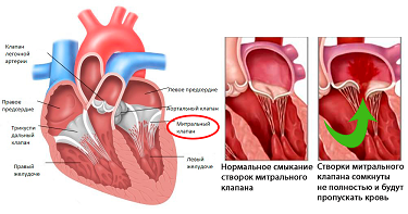 ИБС.png