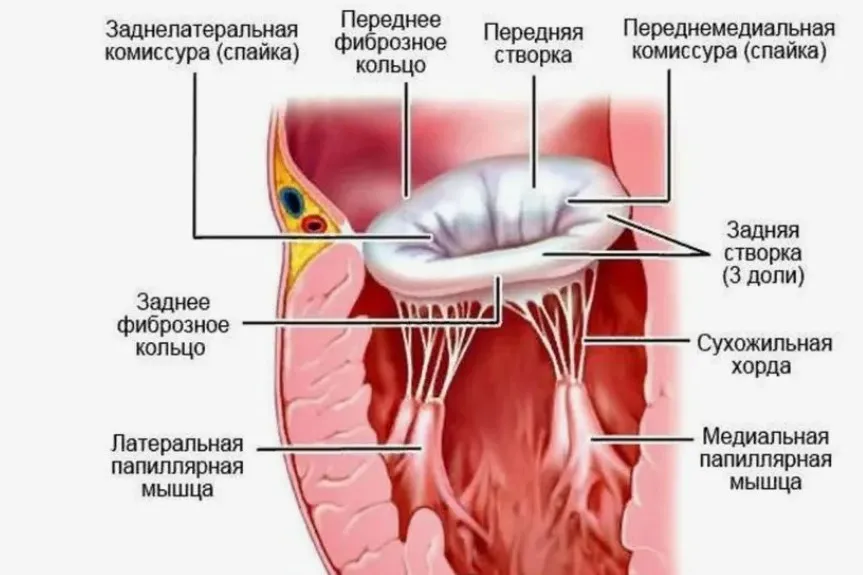 Минимально инвазивное лечение недостаточности митрального клапана с помощью устройства MitraClip